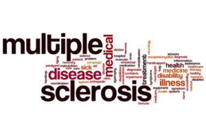 La storia di Sara: un caso di Sclerosi Multipla